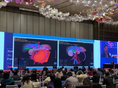 青大附院院長董蒨 海信CAS走向全球，展示中國根技術在國際前沿舞臺